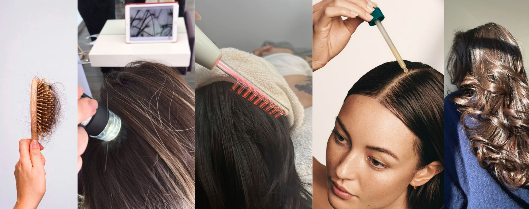 Processus de la repousse des cheveux. Billan capillaire.